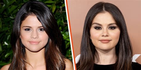 selina gomez tits|Selena Gomez Plastic Surgery Revealed! Before and After